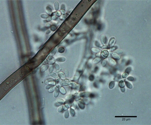 Conídios e conidióforo de Botrytis cinerea