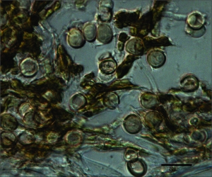 Ustilósporos de Entyloma dahliae