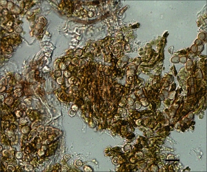 Ustilósporos de Entyloma dahliae