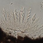 Ascas com ascósporos em diferentes fases de desenvolvimento e paráfises aderidos a base de um estroma rompido.