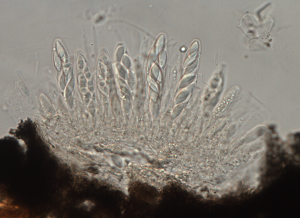 Ascas com ascósporos em diferentes fases de desenvolvimento e paráfises aderidos a base de um estroma rompido.