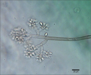 Conídios e conidióforo de Botrytis cinerea