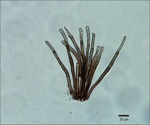 Esporodóquio de Cercospora grandissima