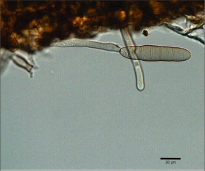 Conídio e conidióforo de Alternariaster