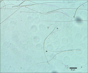 Conídios de Cercospora grandissima