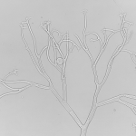 Esporângioforo com ramificação dicotômica e ramos terminando em apófise com dentículo. E esporângio esférico