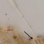 Detalhe de um conidióforo emergindo do estômato da folha de pimentão (indicado por seta)