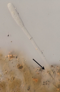 Detalhe de um conidióforo emergindo do estômato da folha de pimentão (indicado por seta)