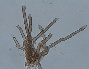 Conidióforos de Cercospora carotae