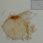Picnidio globoso, com conidios septados e hialinos.