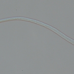 Conidio hialino com cicatriz protuberante