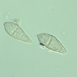 Conídios piriformes hialinos com dentículo na sua base