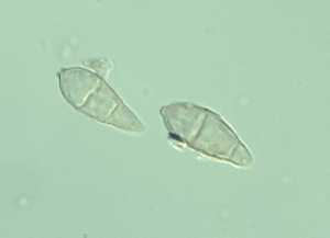 Conídios piriformes hialinos com dentículo na sua base