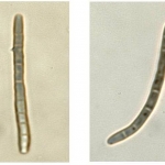 Conídio afilado, longo e multiseptado.