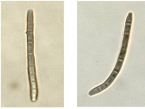 Conídio afilado, longo e multiseptado.