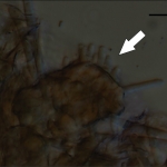 Conidióforos, escala indica 20µm