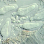 Ascas bitunicadas imaturas, escala indica 20µm