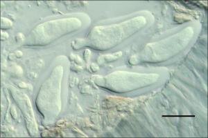 Ascas bitunicadas imaturas, escala indica 20µm