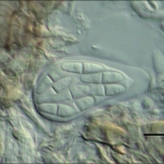 Asca com ascosporos dentro, escala indica 20µm