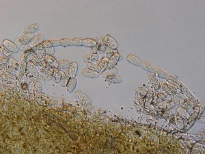 Conidióforo e conídos sobre hospedeiro