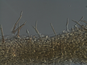 Conidióforos sobre tecido do hospediro