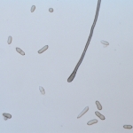 Conídios e conidióforo de Cladosporium colacasiae .