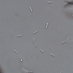 Conídios de C. gloeosporioides.