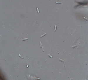 Conídios de C. gloeosporioides.