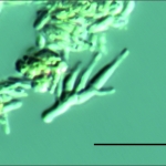 Conidióforo em destaque, escala indica 20µm