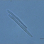 Conídios, escala indica 20µm