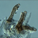 Conidióforos, escala indica 20µm