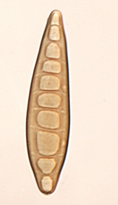 Conídios fusóides, obloclavados a quase cilíndricos, marrom claro. Presença de hilo.