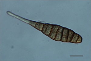 Conídio em destaque, escala indica 20µm