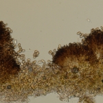 Esporodóquio com conidióforos pigmentados com conídios verruculoso pigmentados ou hialinos