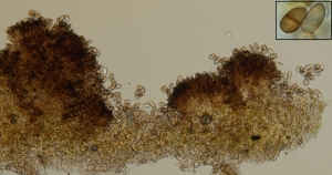 Esporodóquio com conidióforos pigmentados com conídios verruculoso pigmentados ou hialinos