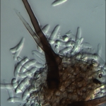 Setas e conídios, escala indica 20µm