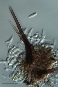 Setas e conídios, escala indica 20µm