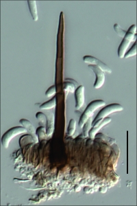 Setas e conídios, escala indica 20µm